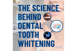 The Science Behind Dental Tooth Whitening
