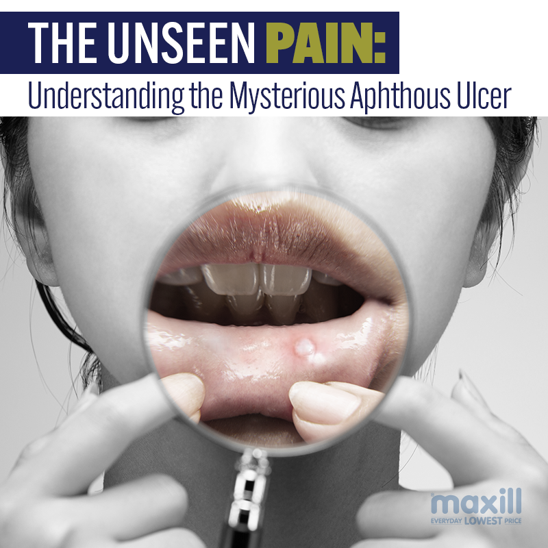 The Unseen Pain: Understanding the Mysterious Aphthous Ulcer