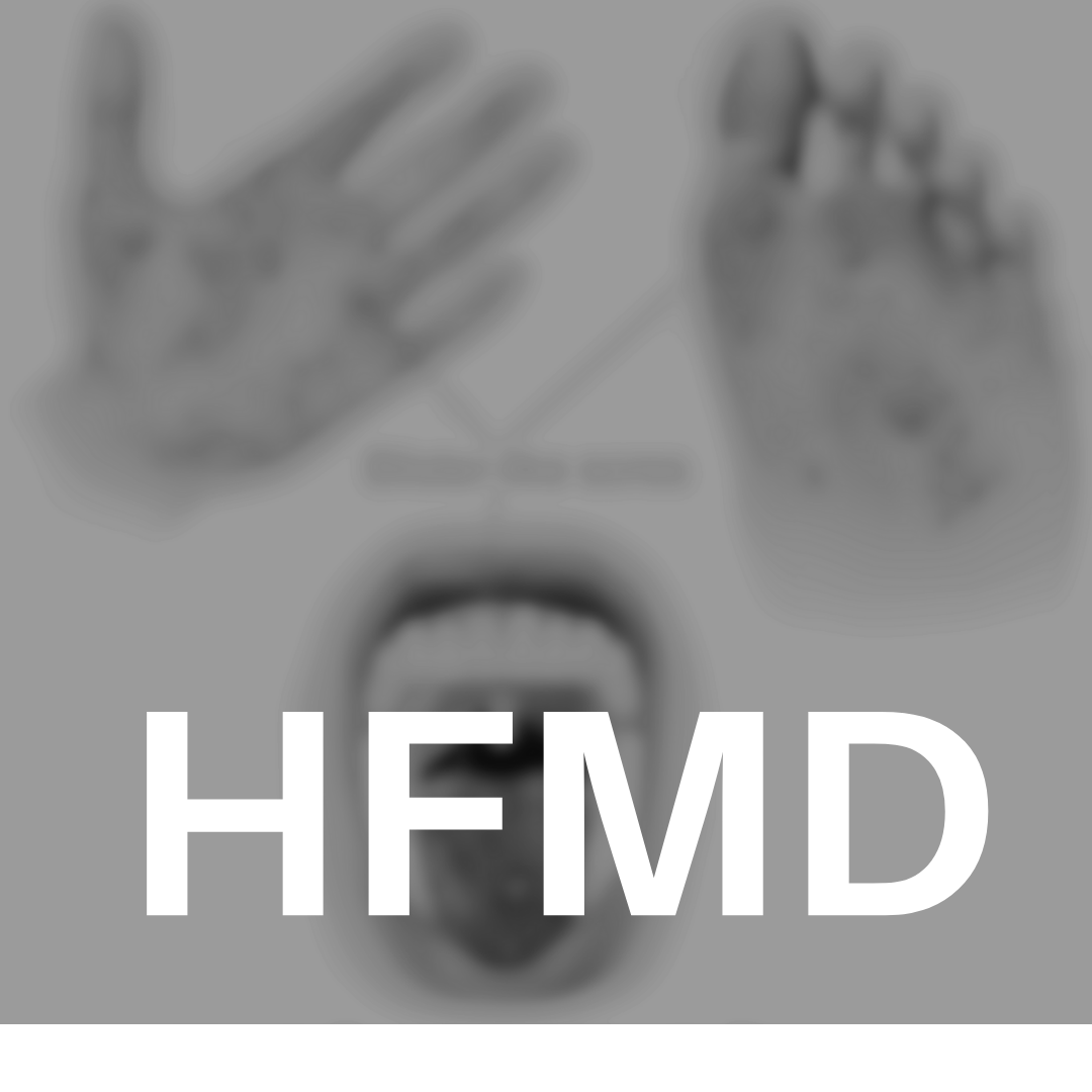 hfmd 