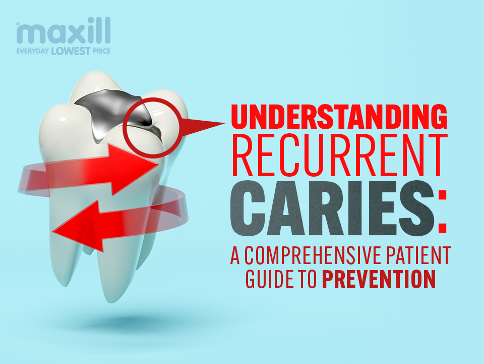 Understanding Recurrent Caries: A Comprehensive Patient Guide to Prevention
